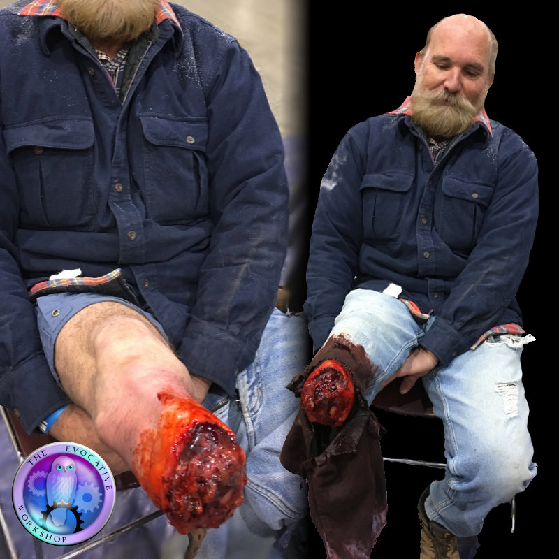 Make up   Moulage_GCPGA Leg Amputee