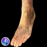 Make up   Moulage_GCPGA Broken Ankle